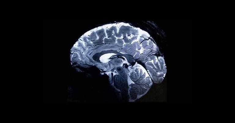 The world's most powerful MRI scanner has unveiled the first-ever images of the human brain, promising unprecedented insights into its complexities and associated afflictions. 