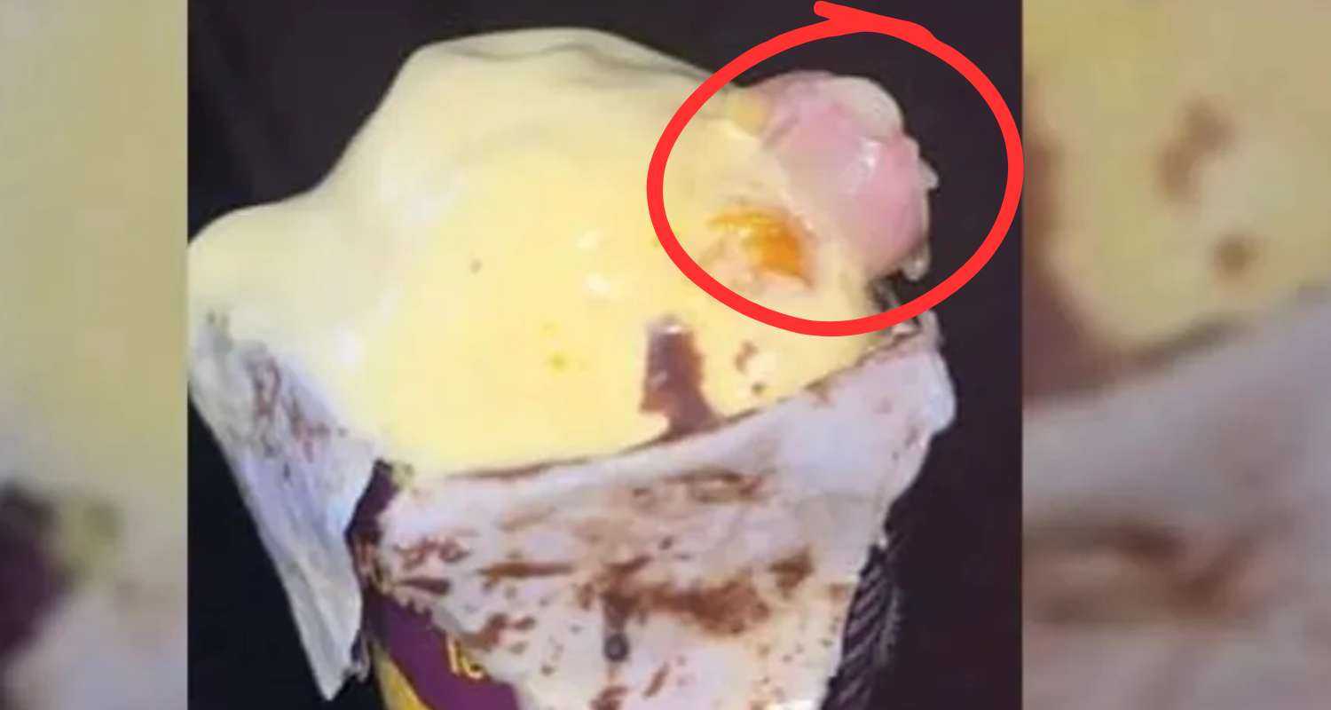 Mumbai doctor found a human thumb in his ice cream. 