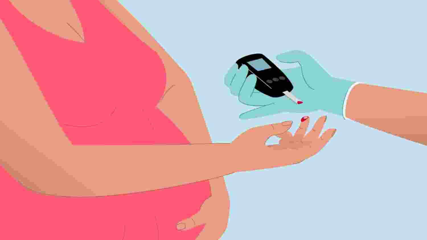 Early gestational diabetes care prevents complications