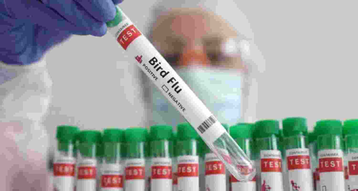 Mexico Man Dies from First Human H5N2 Bird Flu Case.