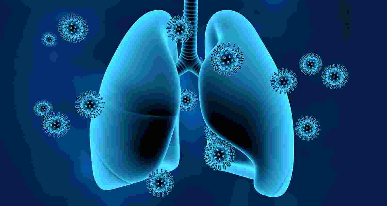 Long COVID inflicts deep scars on the lungs: Study