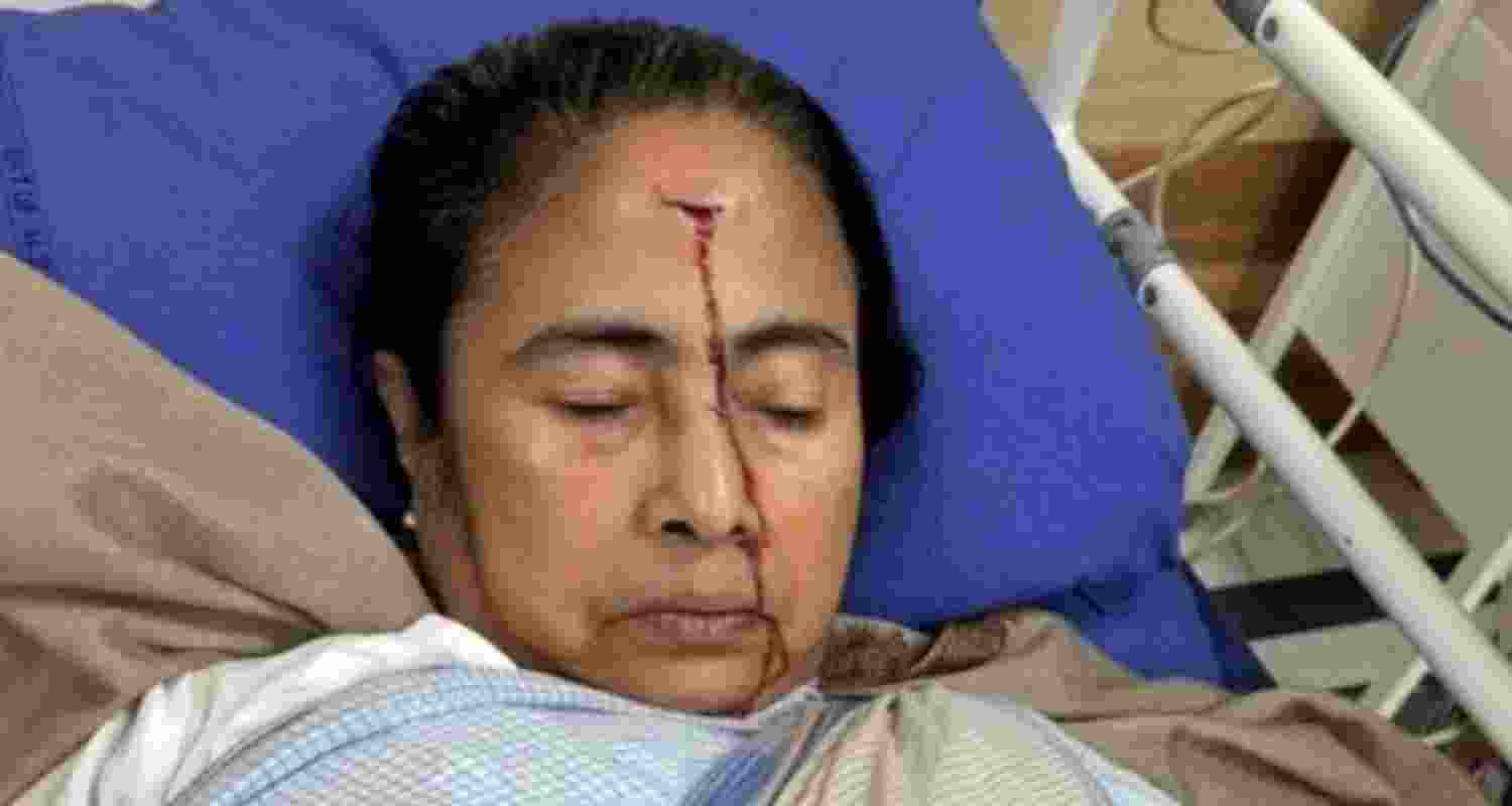 West Bengal Chief Minister Mamata Banerjee injured.