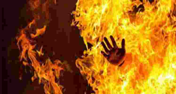 Representative Image of a person setting ablaze. 
