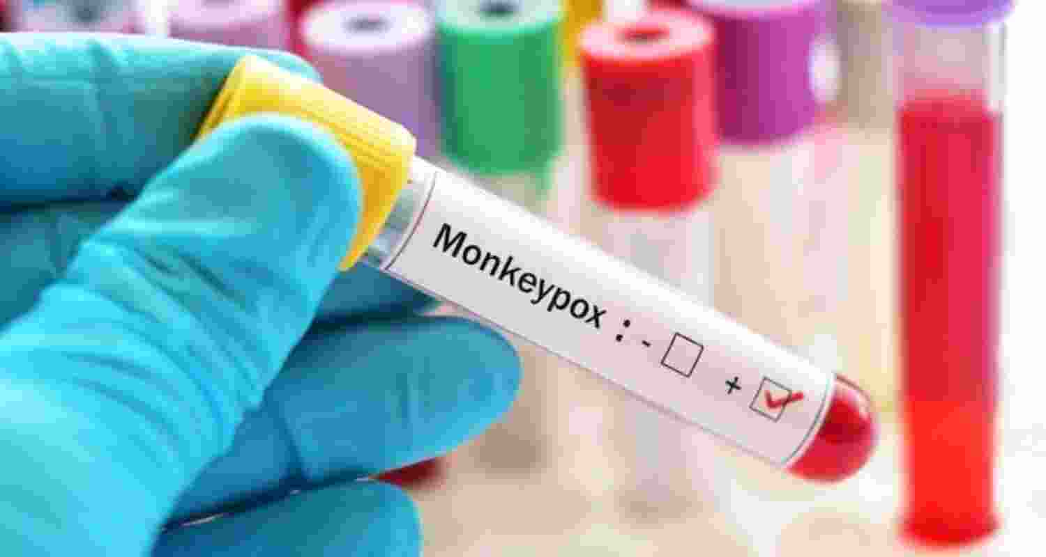 India’s New RT-PCR Test Detects Monkeypox Strains.