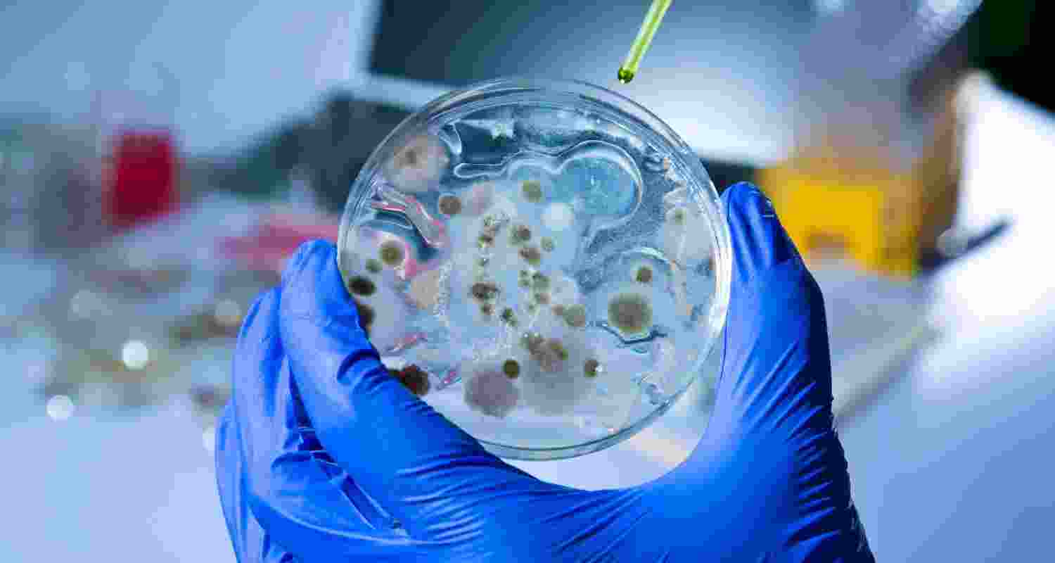Congo declares Ebola outbreak, reports 15 deaths