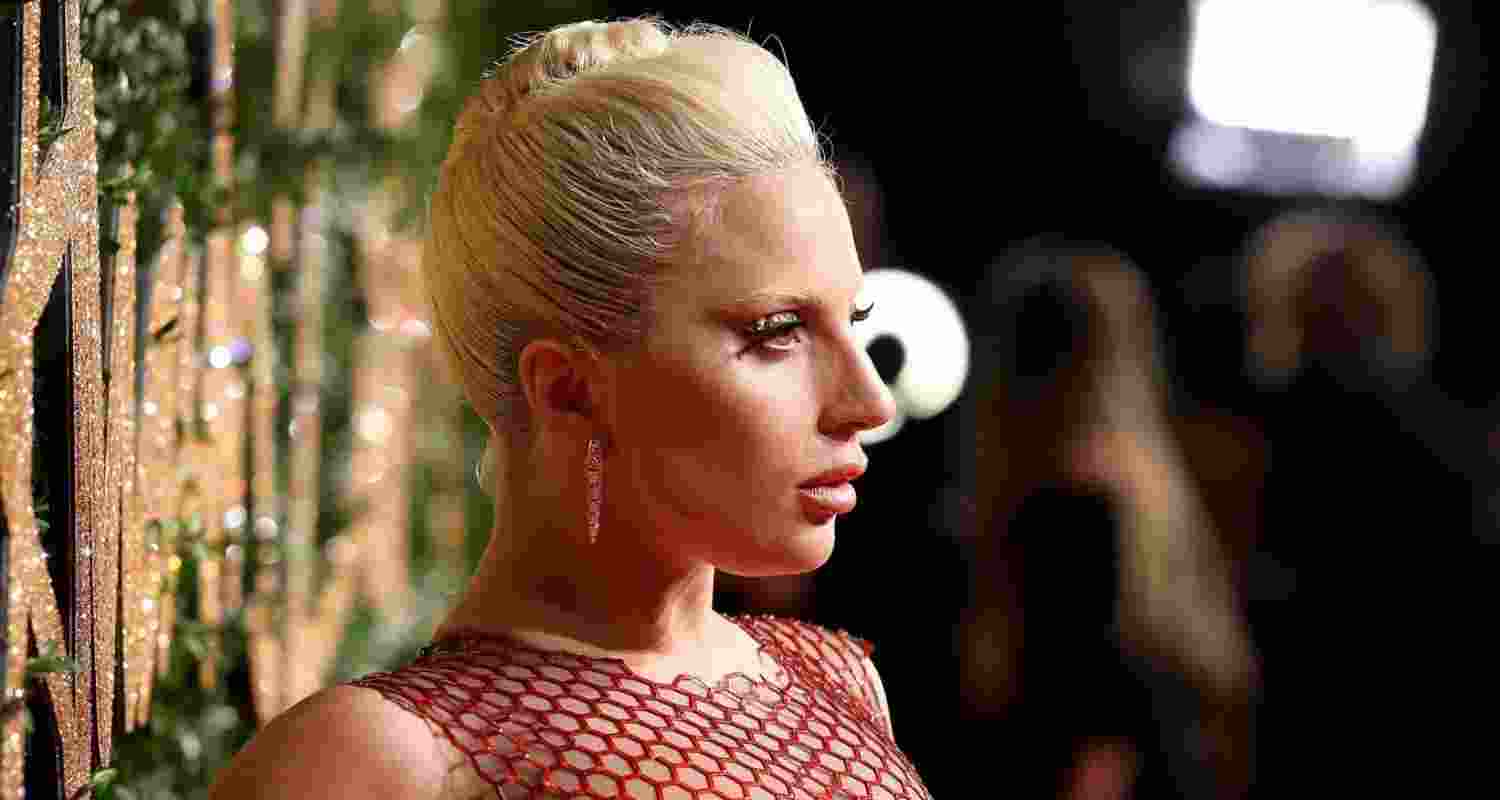 “Abracadabra” singer Lady Gaga. Image: X