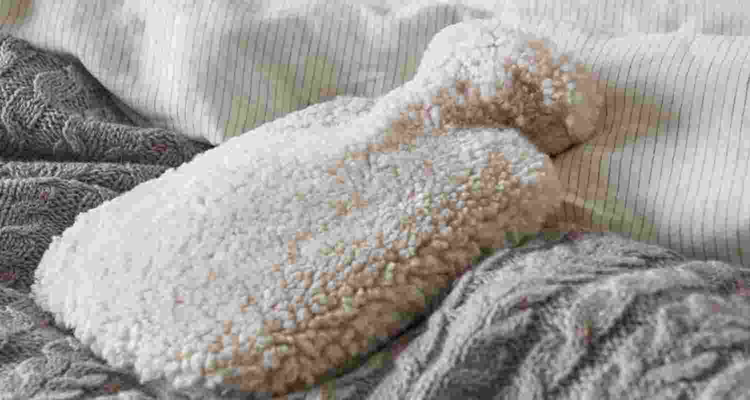 From toasted skin to burns: Hot water bottle hazards