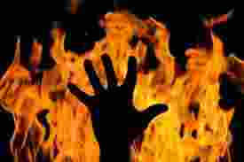 Two sisters burnt alive, one critical in MP's Damoh hut fire