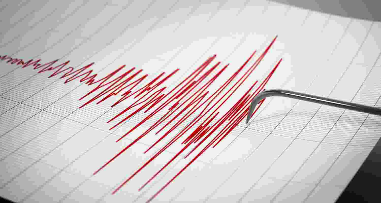 Representative Image. 