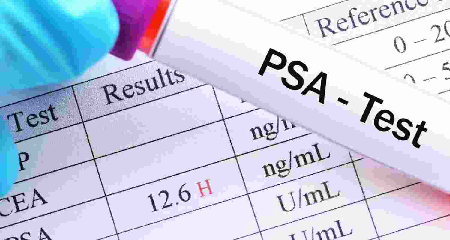 UK advisers reject widespread prostate cancer screening UK advisers reject widespread prostate cancer screening
