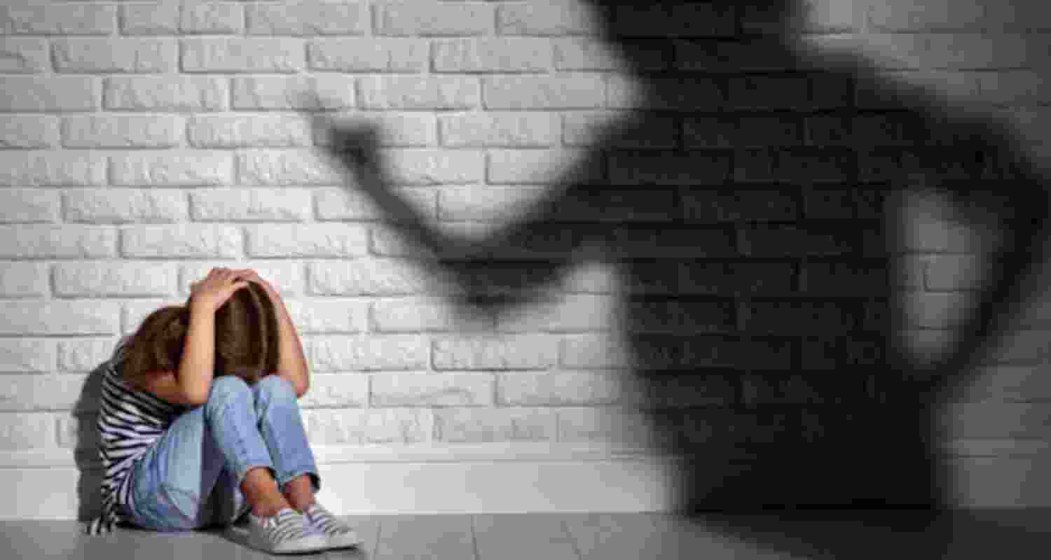 Representational Image. 