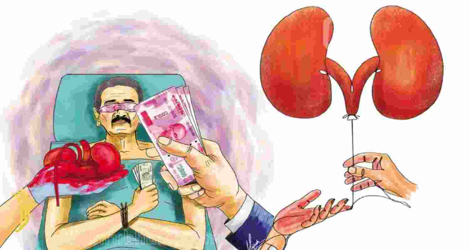 Organ Trafficking Racket Busted in Delhi; Doctor Among Seven Held. Image For Representative Use Only.