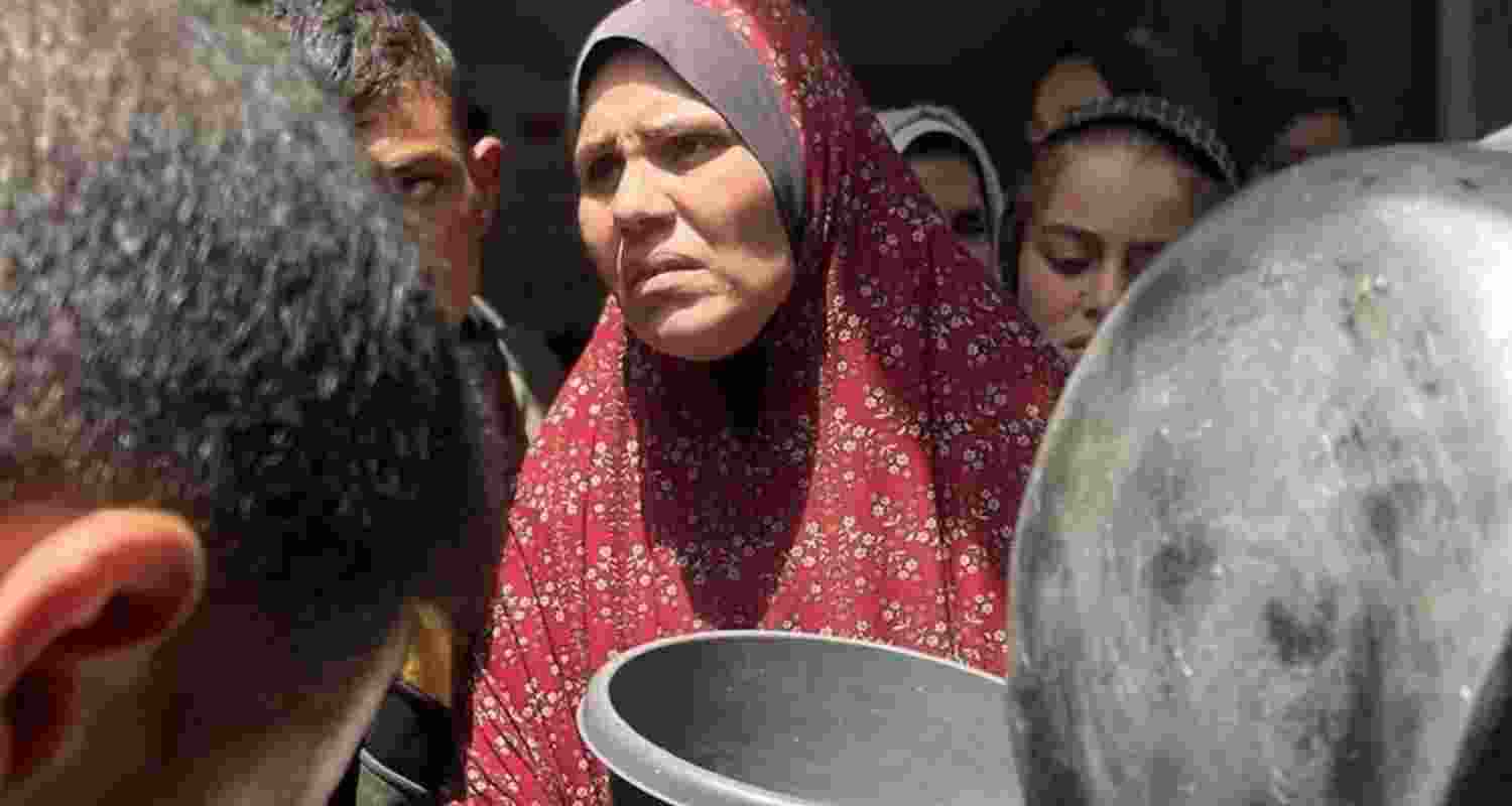 Representational image.