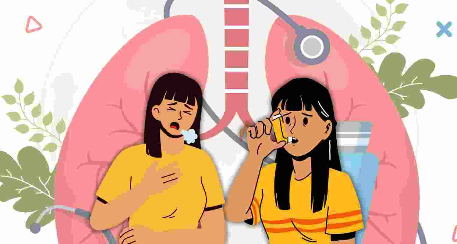 Representative Image. 