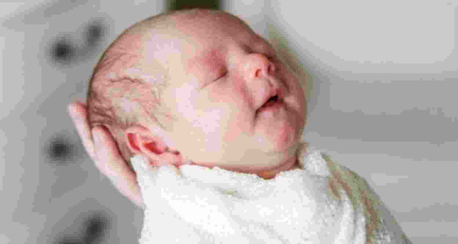 Representational image.