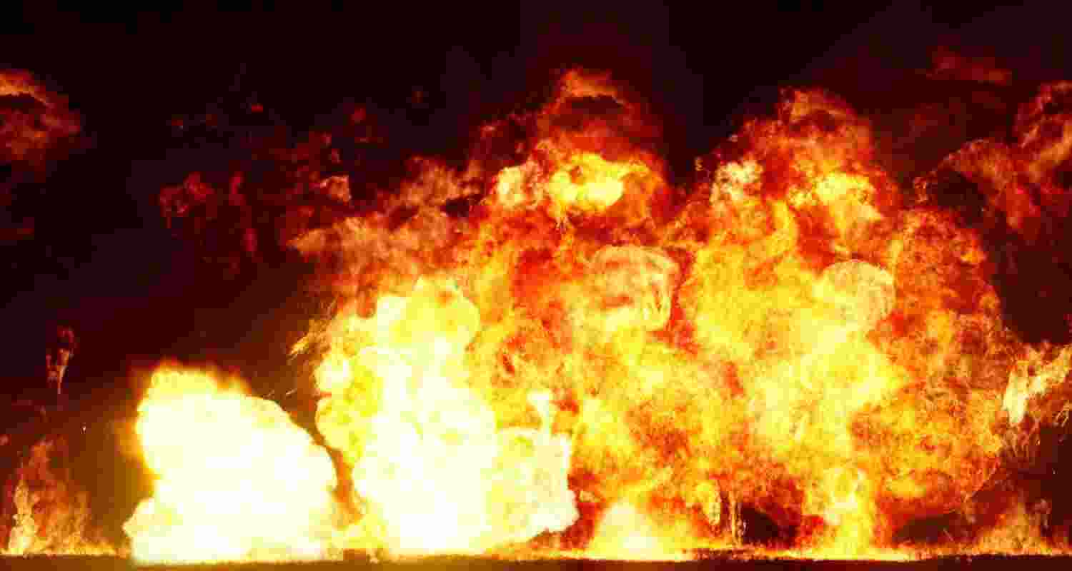 Representative Image. 