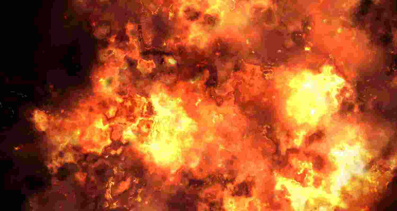 Representative Image. 