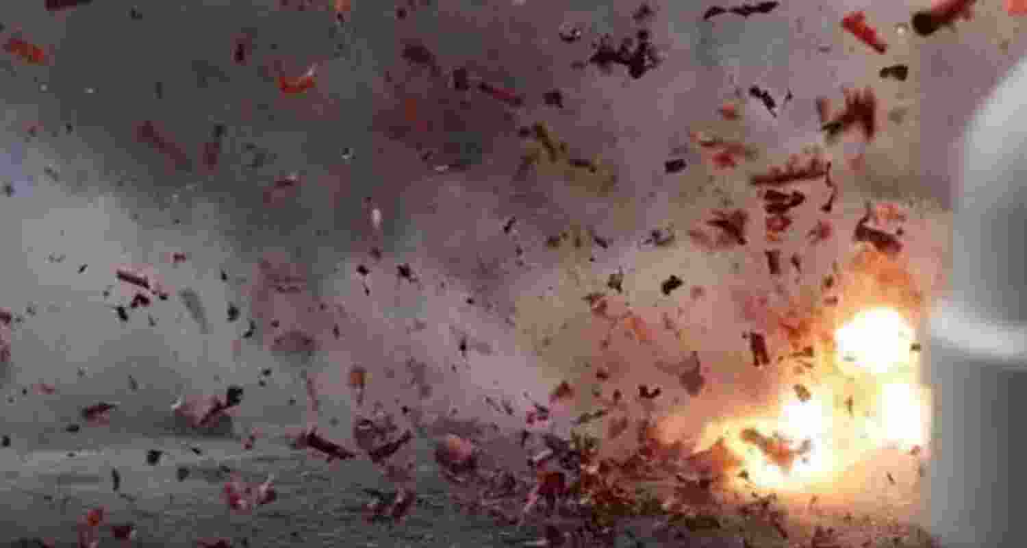 Representative Image. 