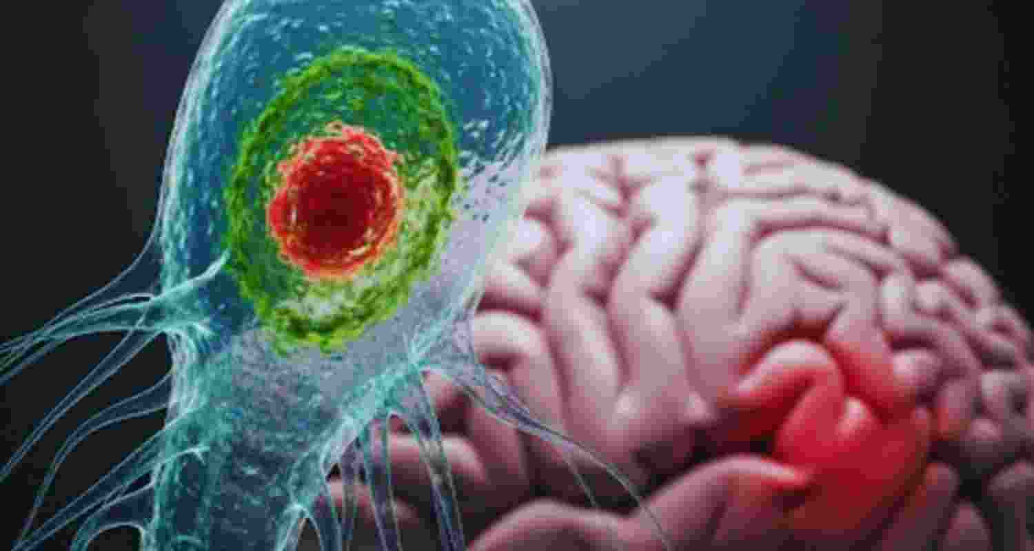 Kerala reports fresh case of rare brain infection