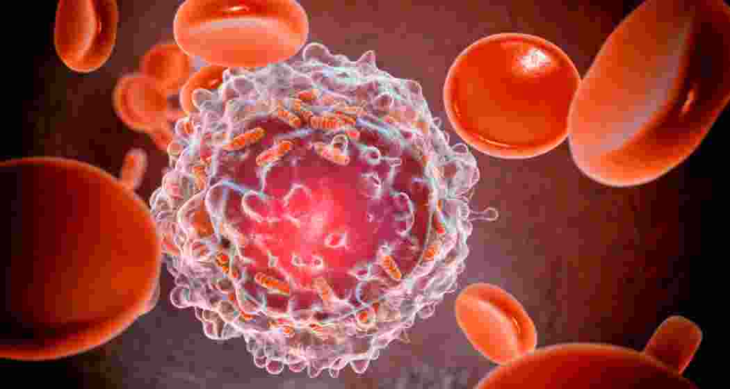 Image for representative use only.