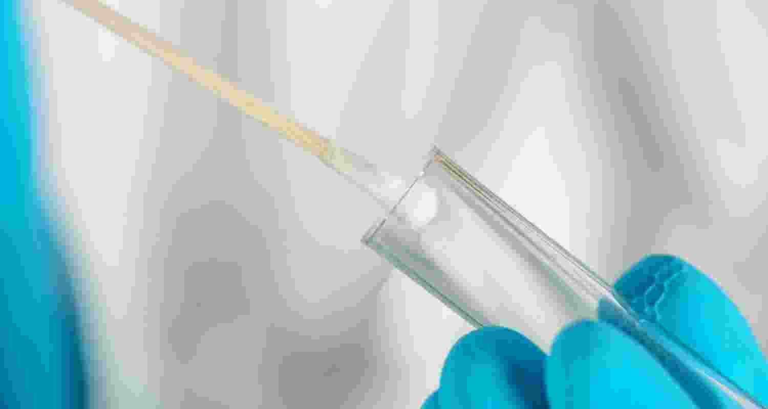 Representative Image. 