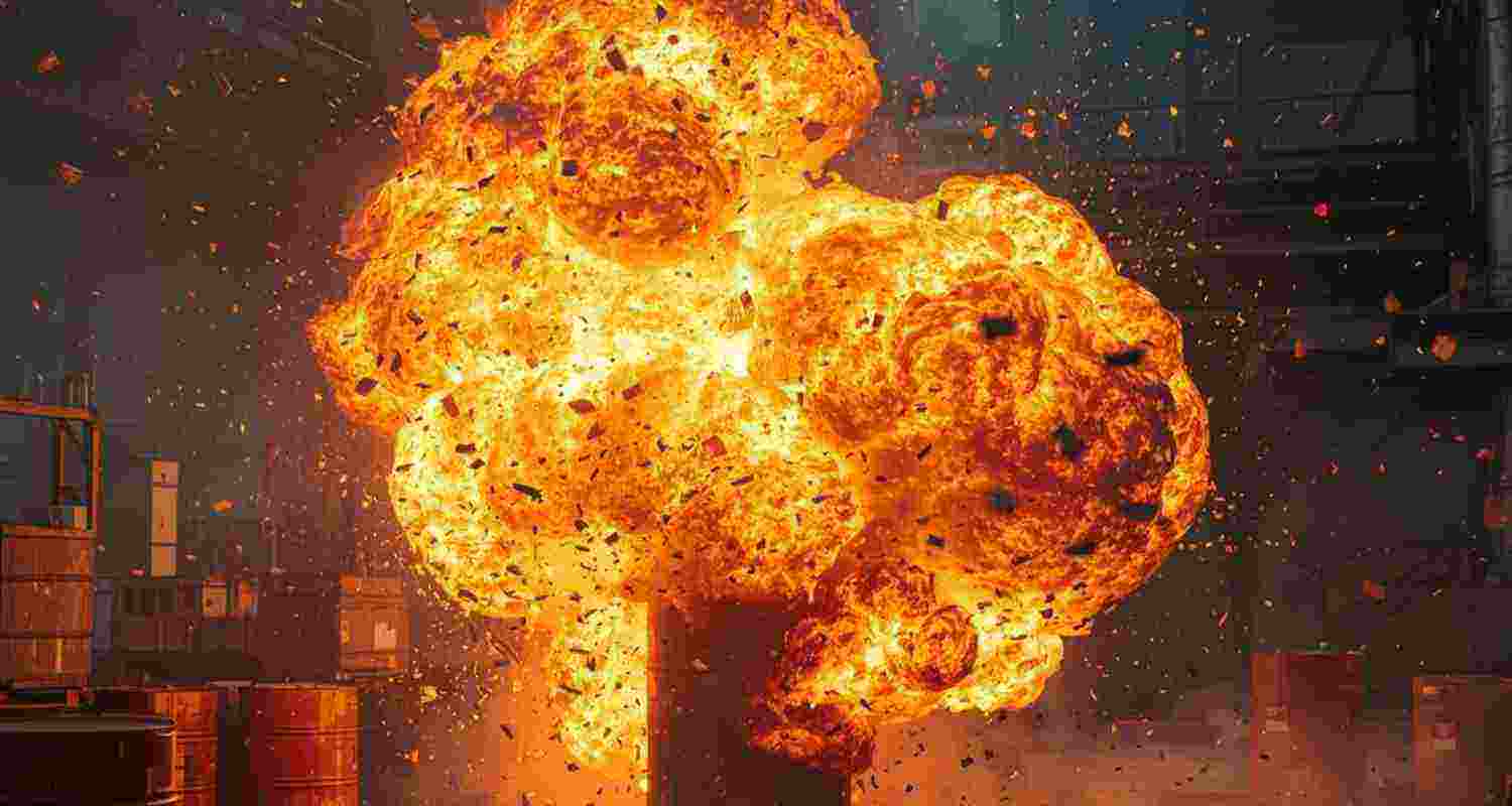 Representative Image. 