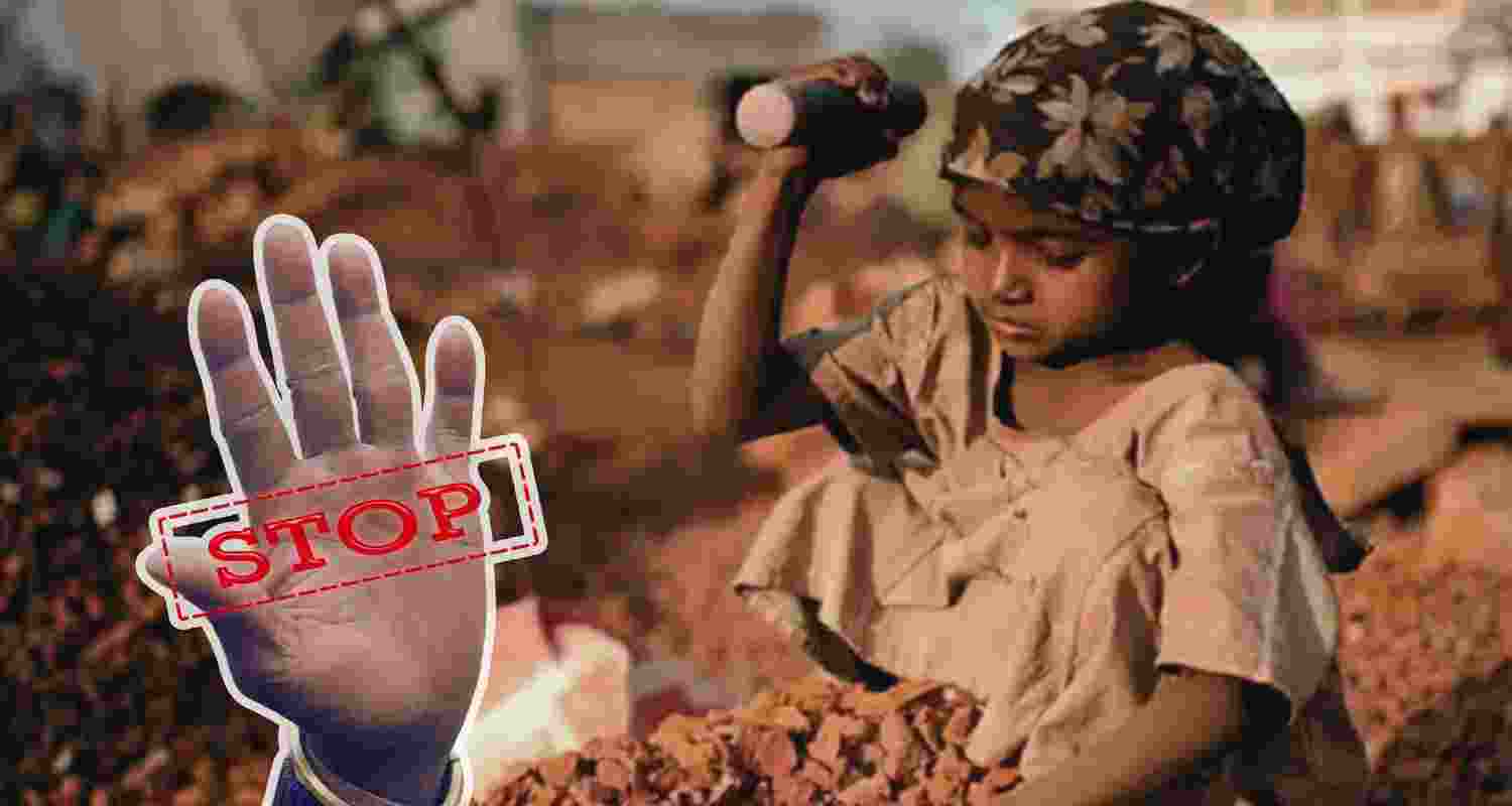 Representative Image. 