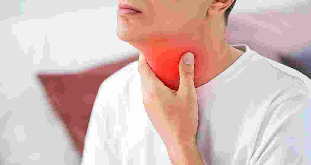 Representative image.