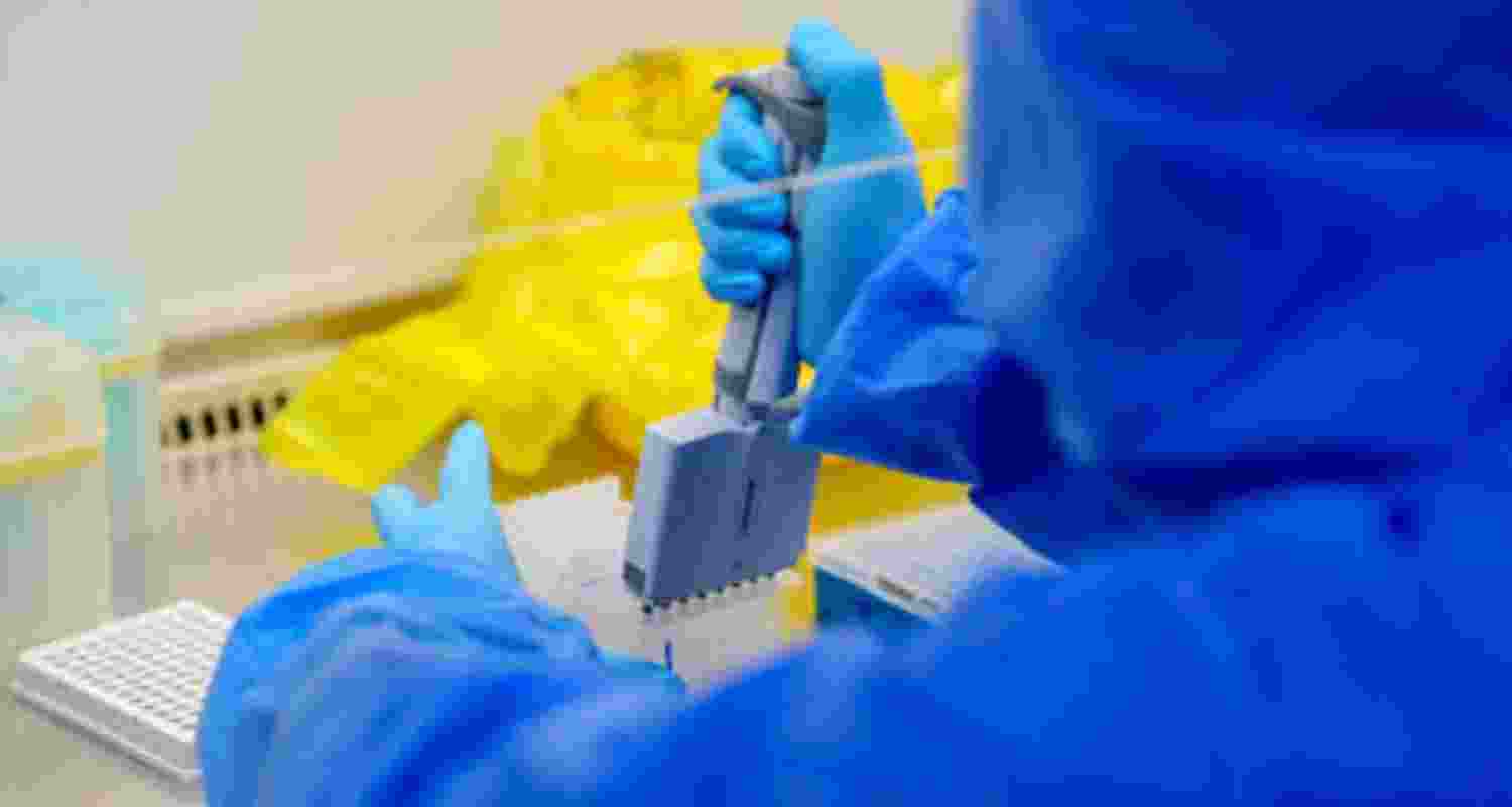 Representational image.