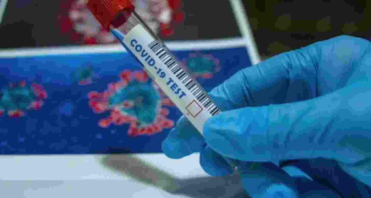 Bengal records three Covid-19 cases, experts urge caution