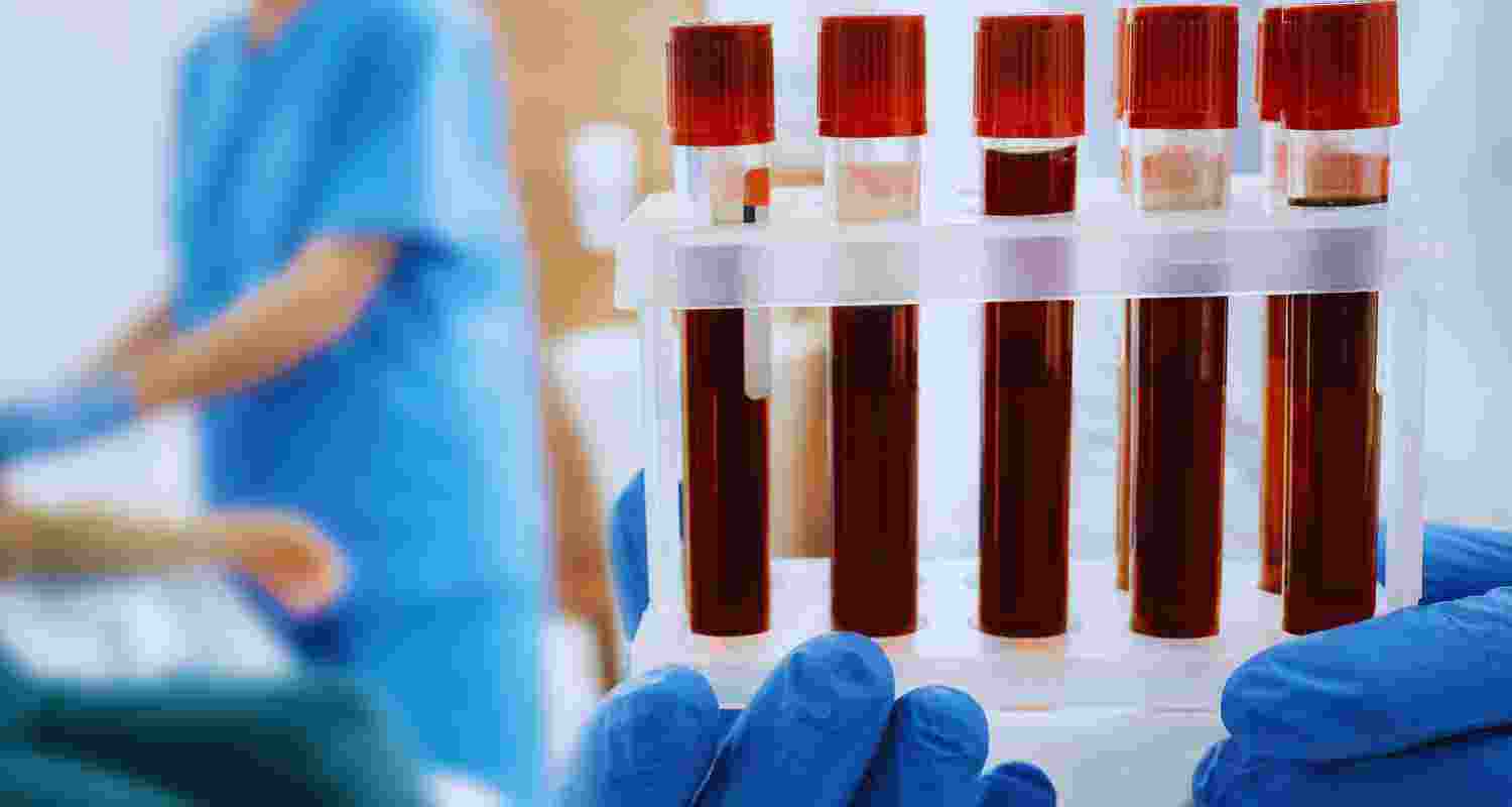 Karnataka scientists discover new blood type