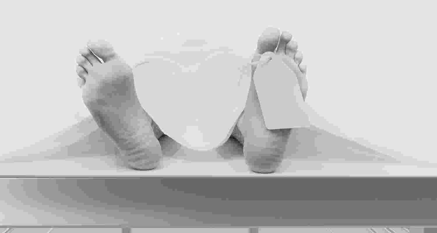 Representative Image. 