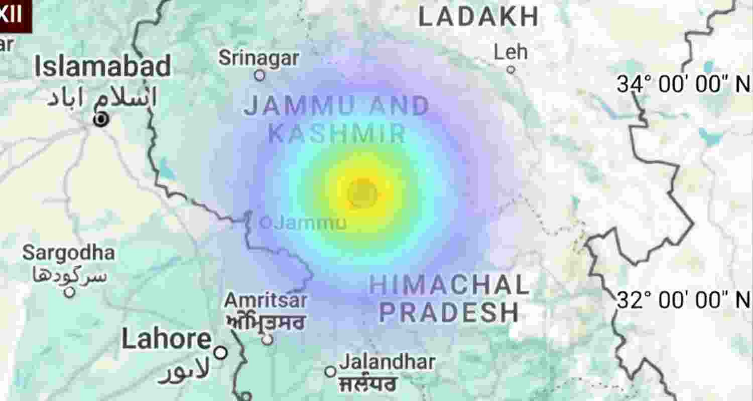 Representative image. 