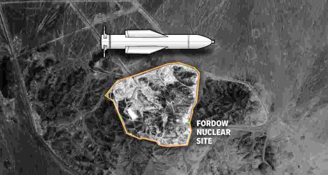 Representative image.