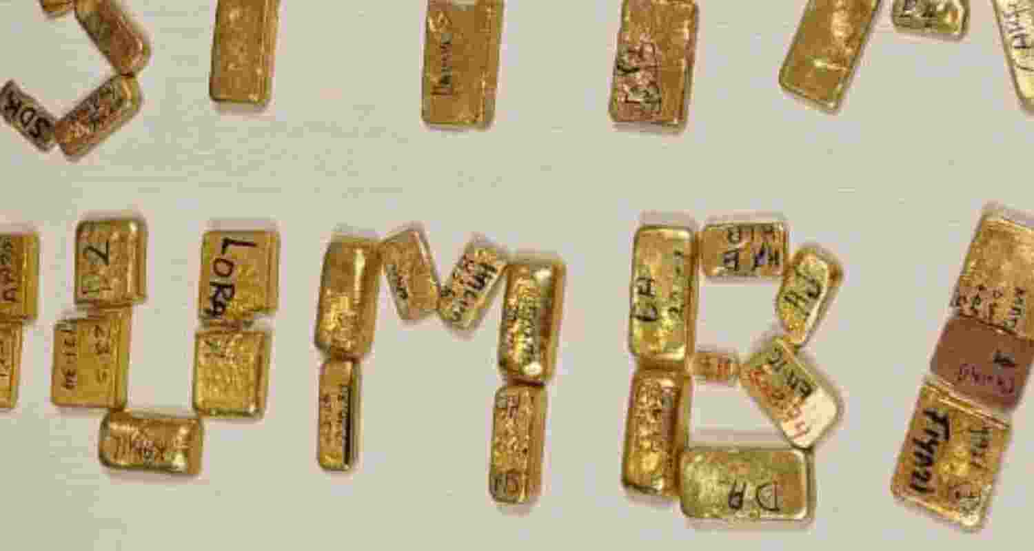 Representative image. 