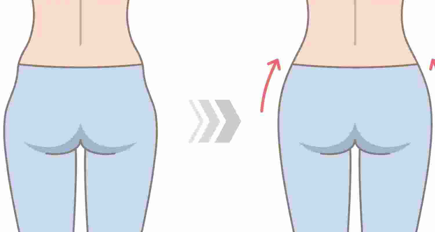 You can’t exercise your hip dips away