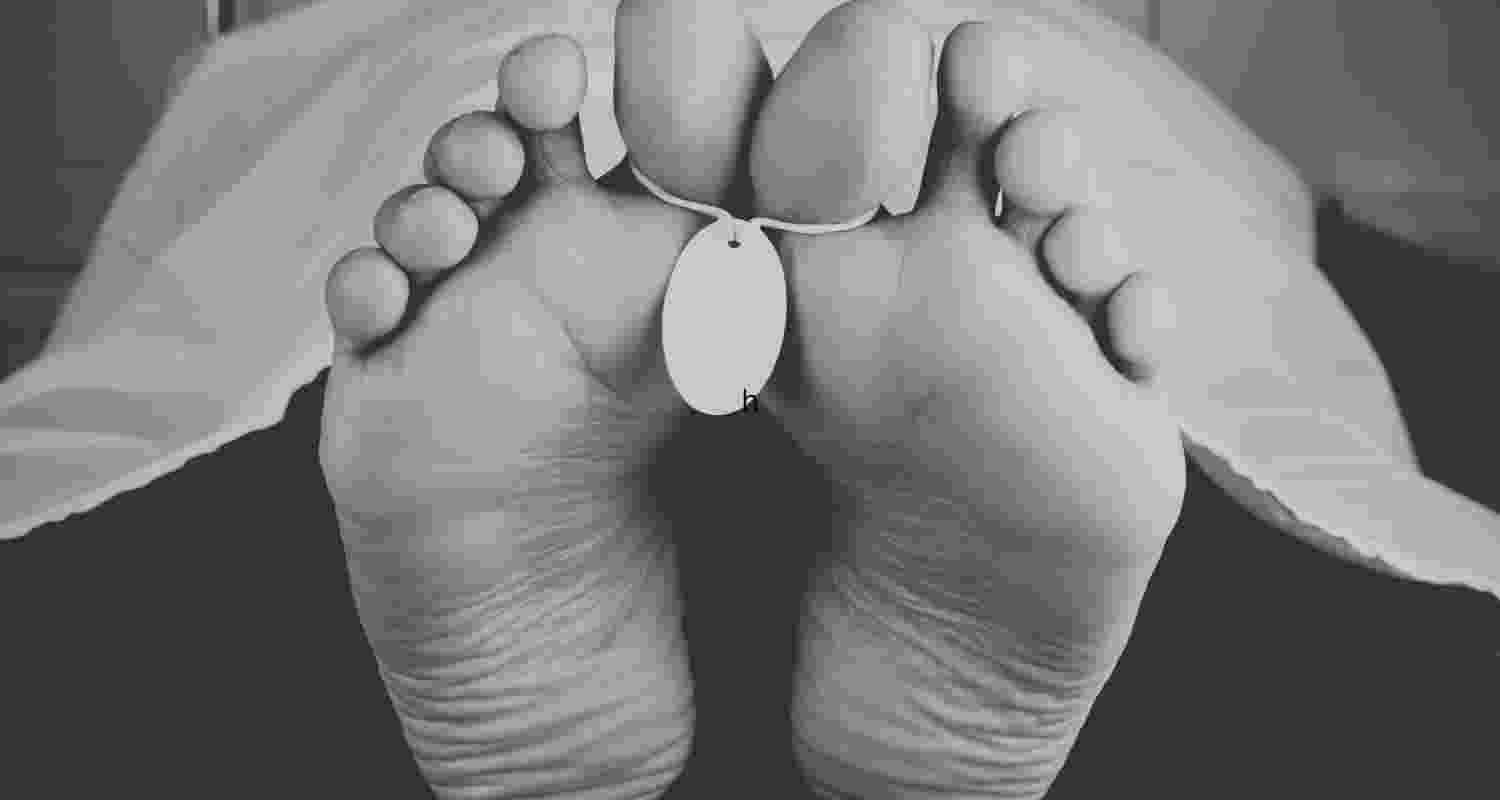 Representative Image. 