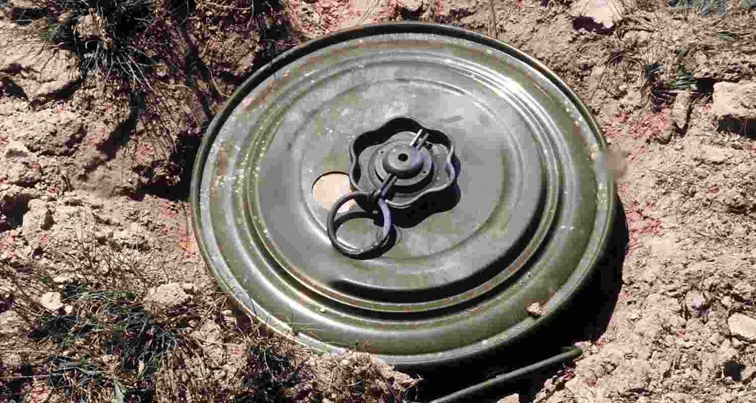 Representative Image. 