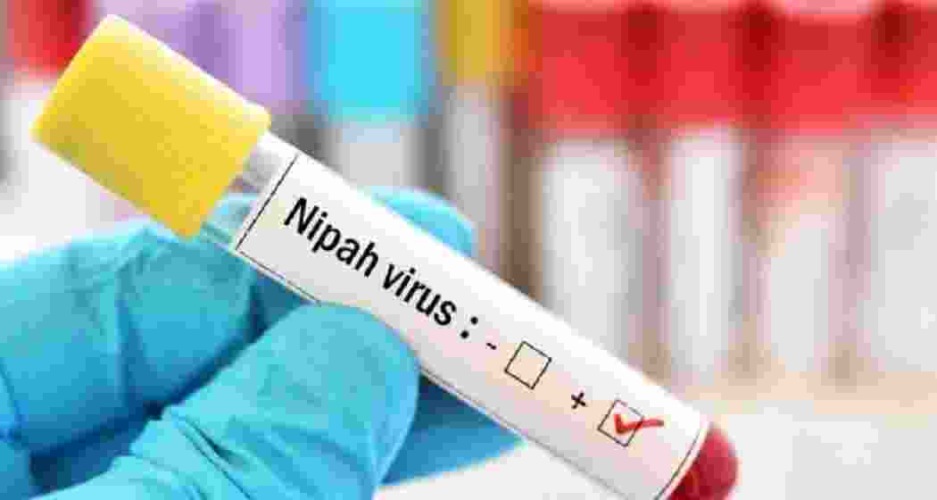 Representational image.