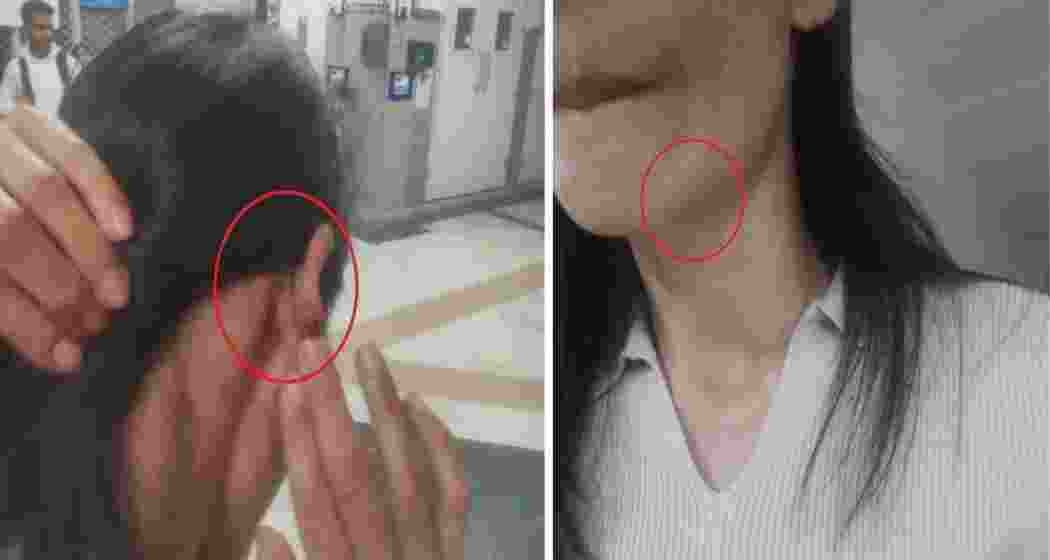 The Manipur woman and her friend from Assam were assaulted near Saket District Court in Delhi after objecting to harassment.