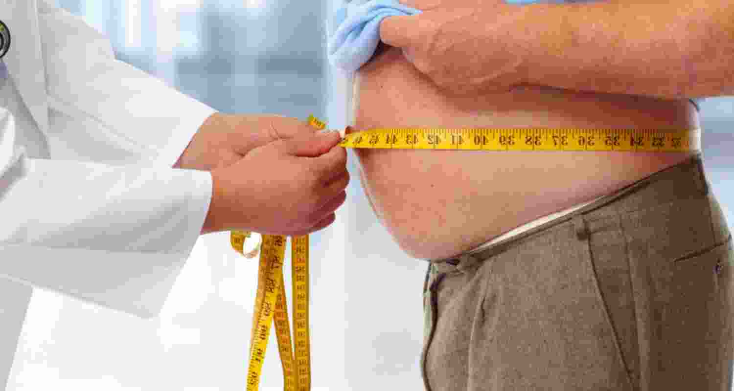 Is obesity a disease? Debate stirs in modern medicine
