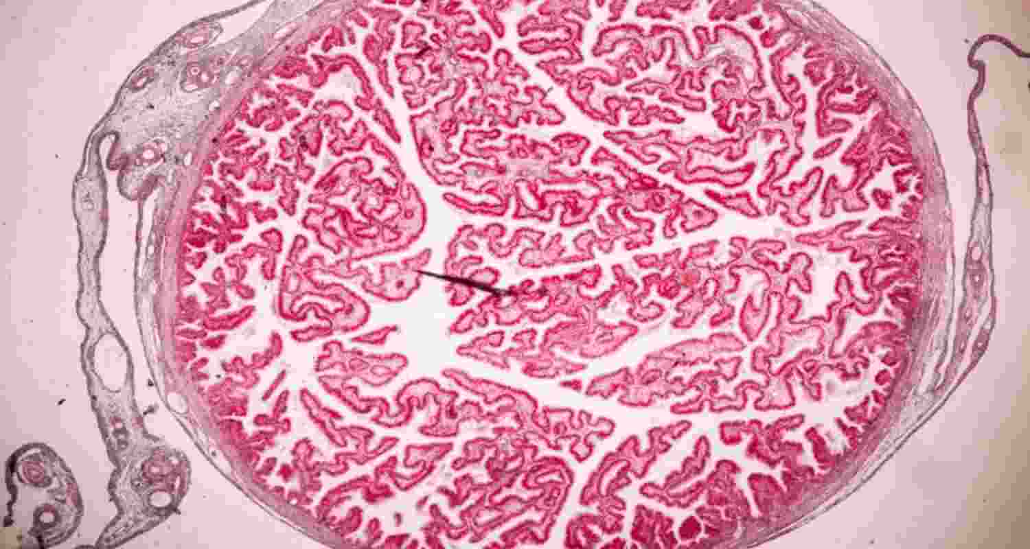Placenta rights: Why mothers should decide its future