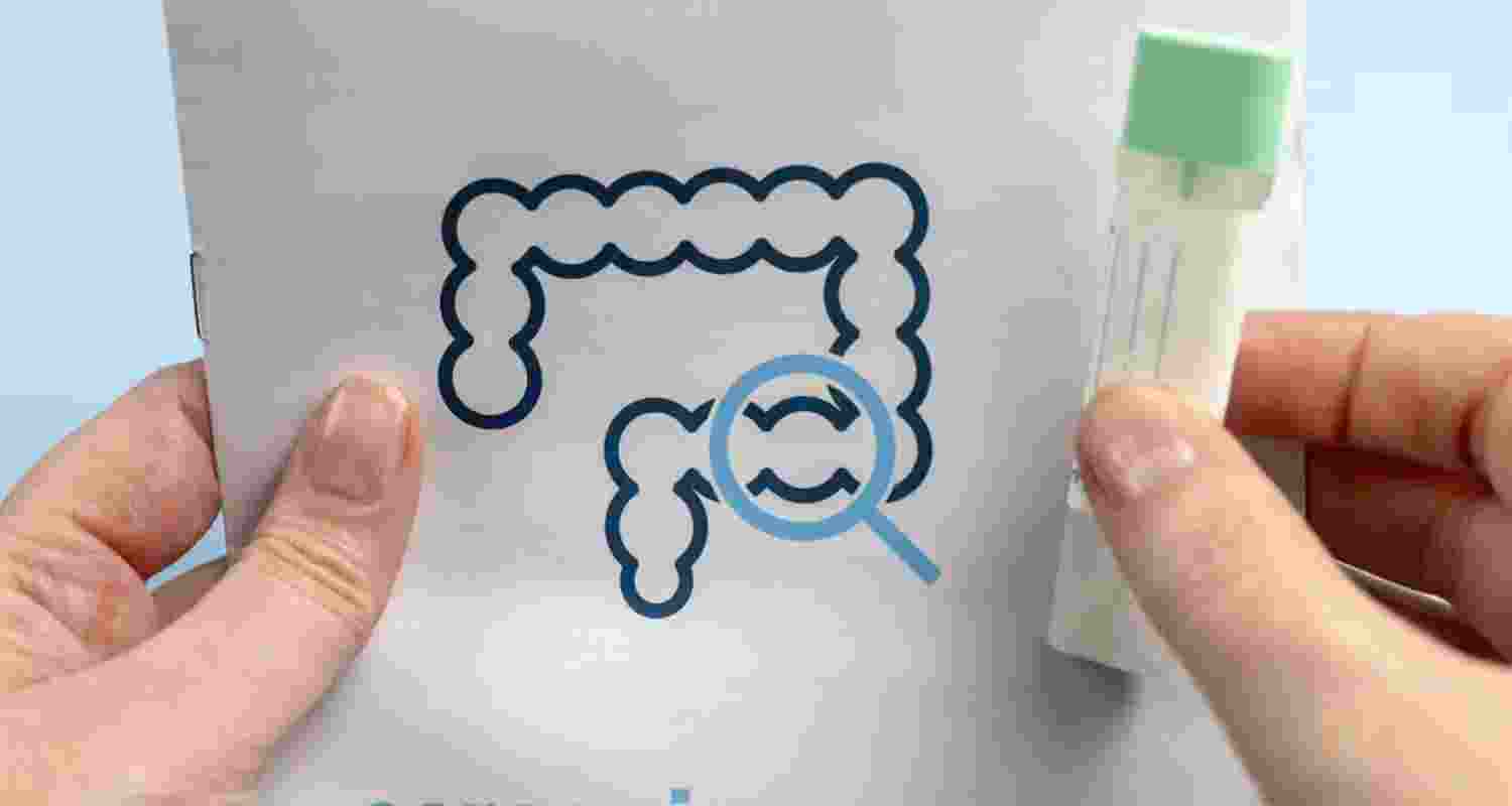 Poop and blood tests approved for colon cancer screening
