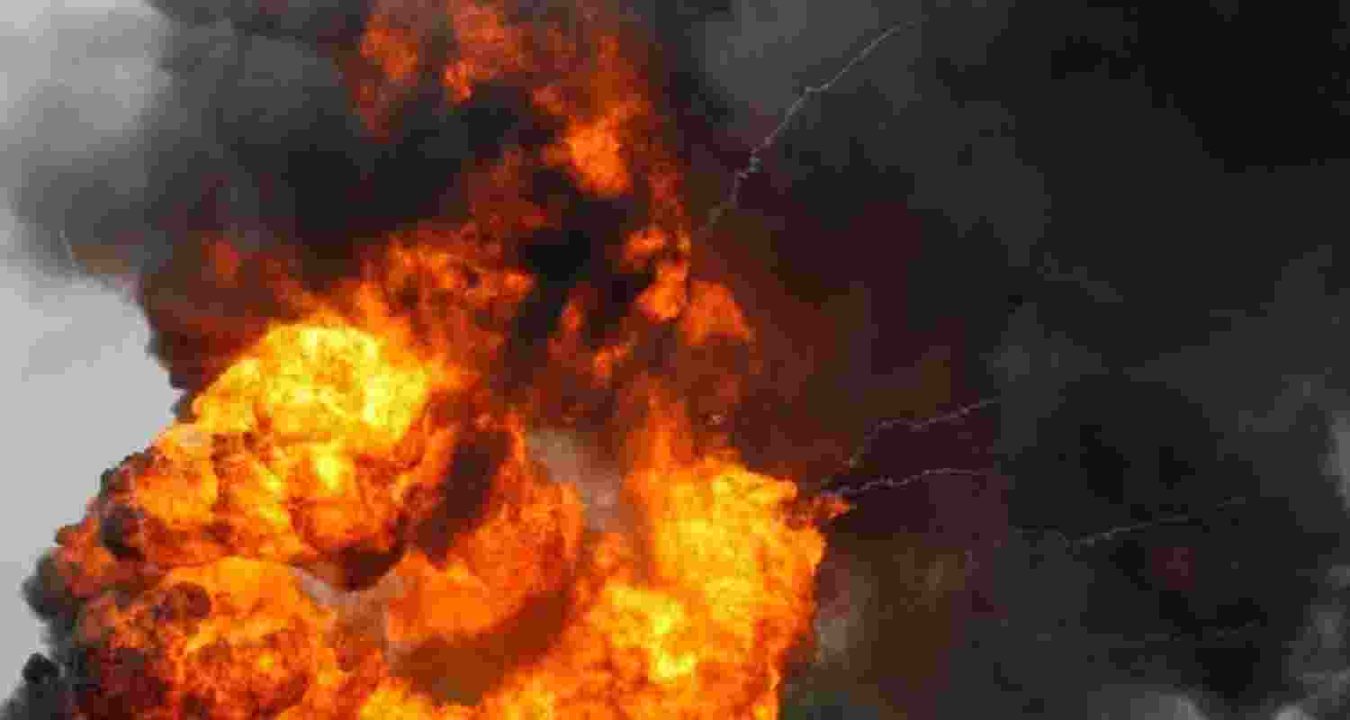 Representational image.