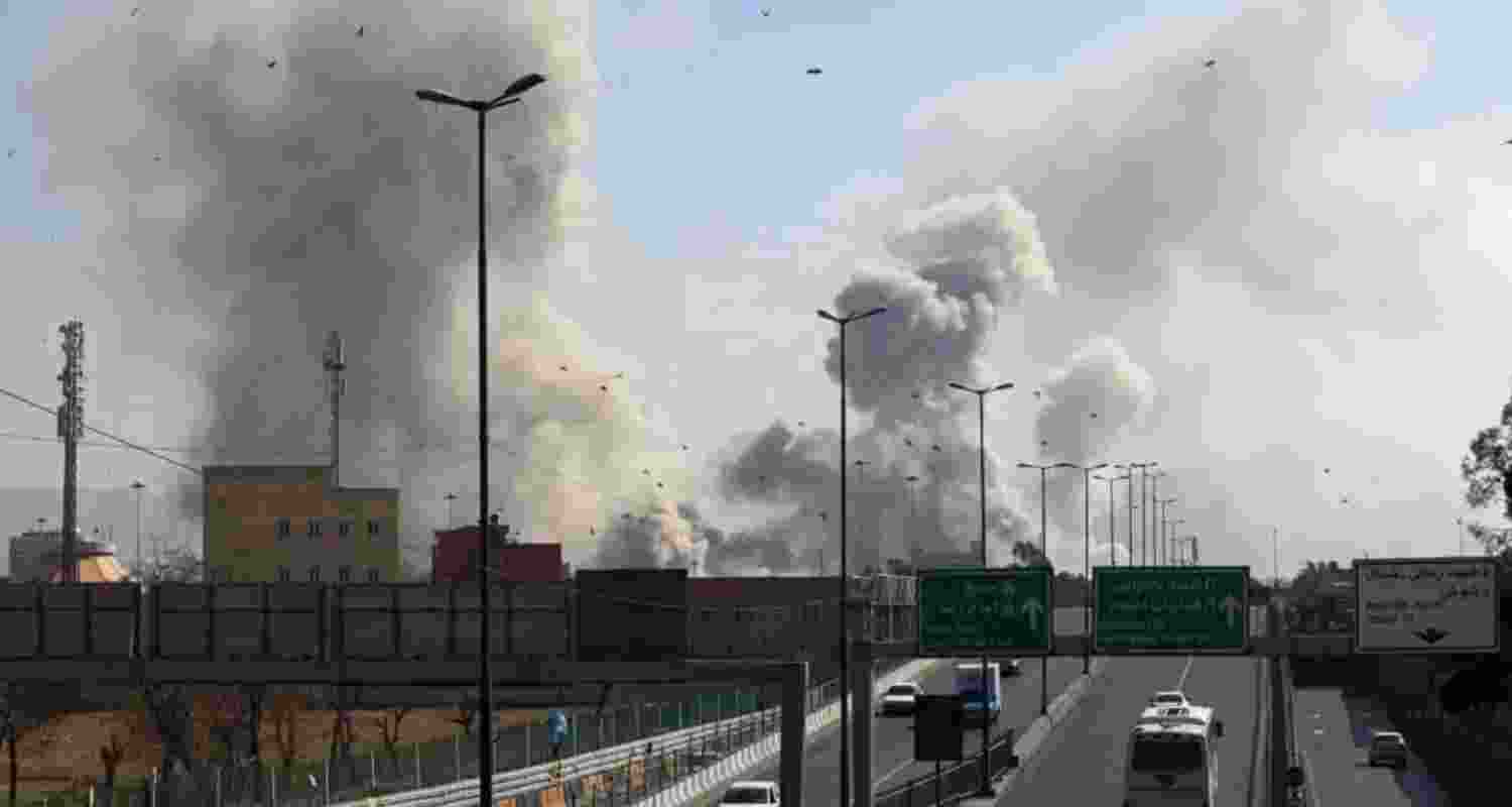 Representational image. 