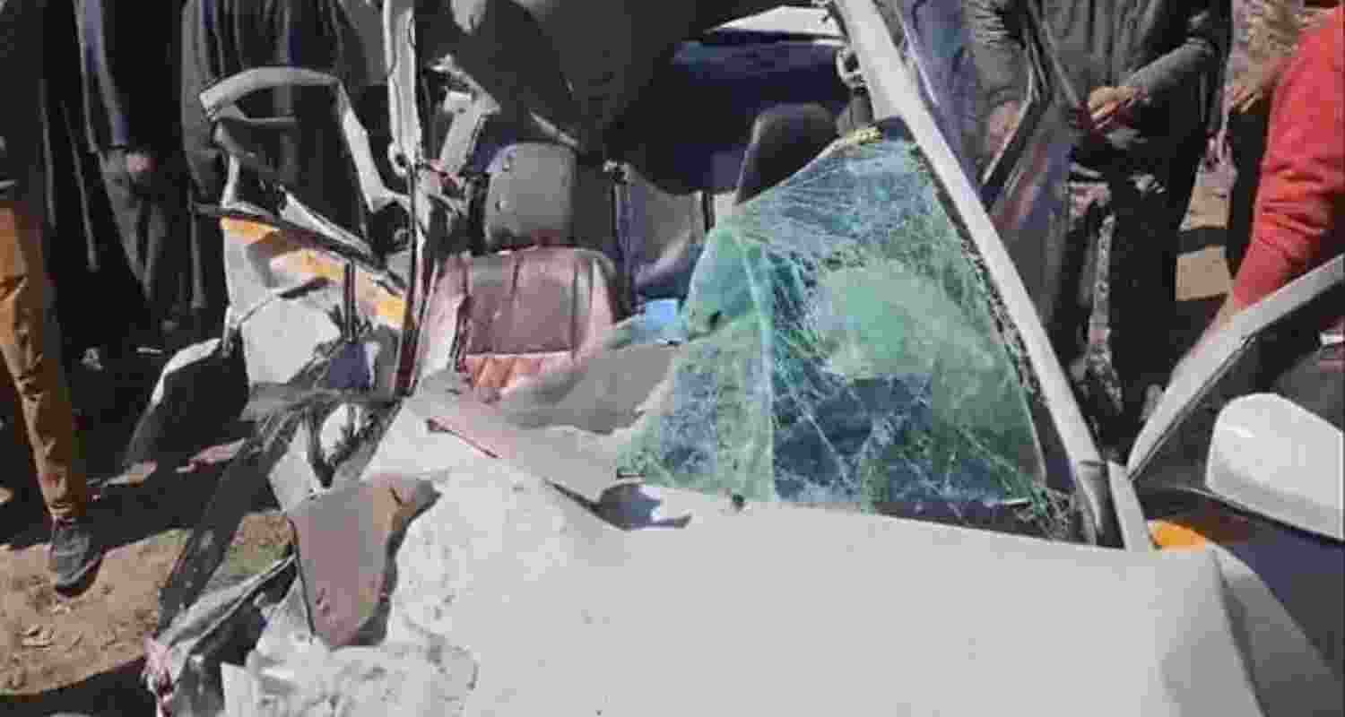 Representational Image.