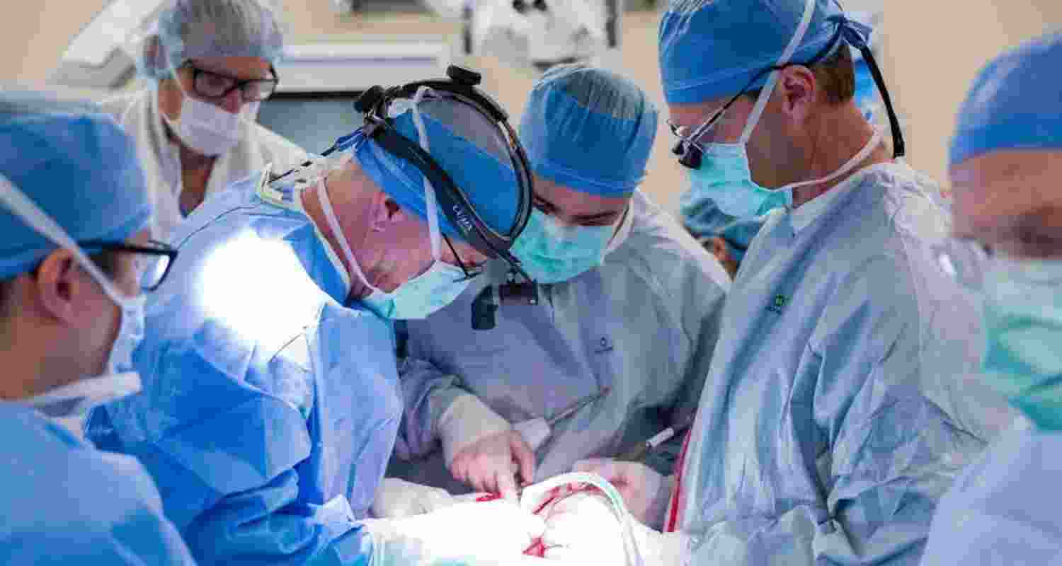 Representational Image. 