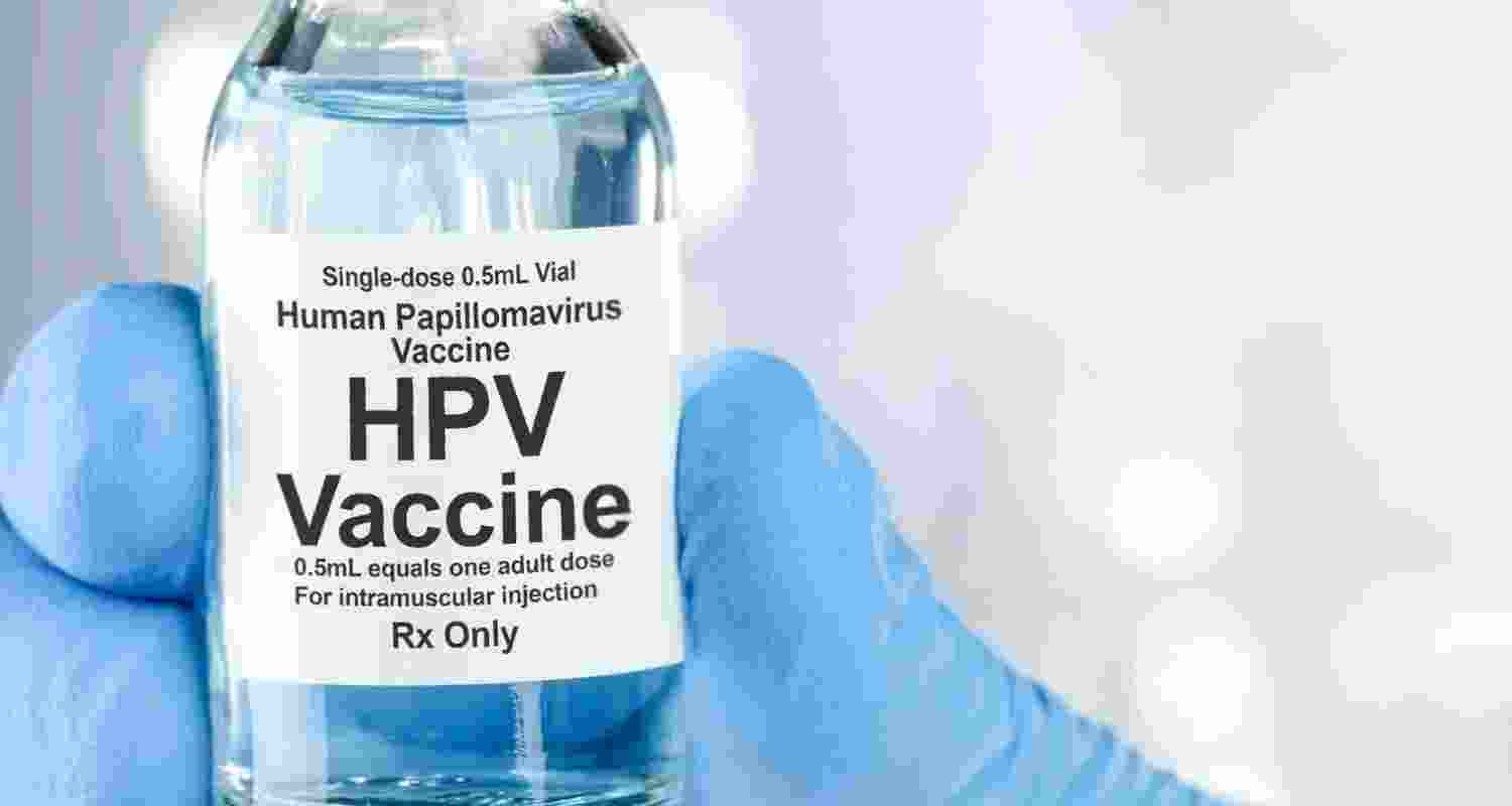 Representational image.