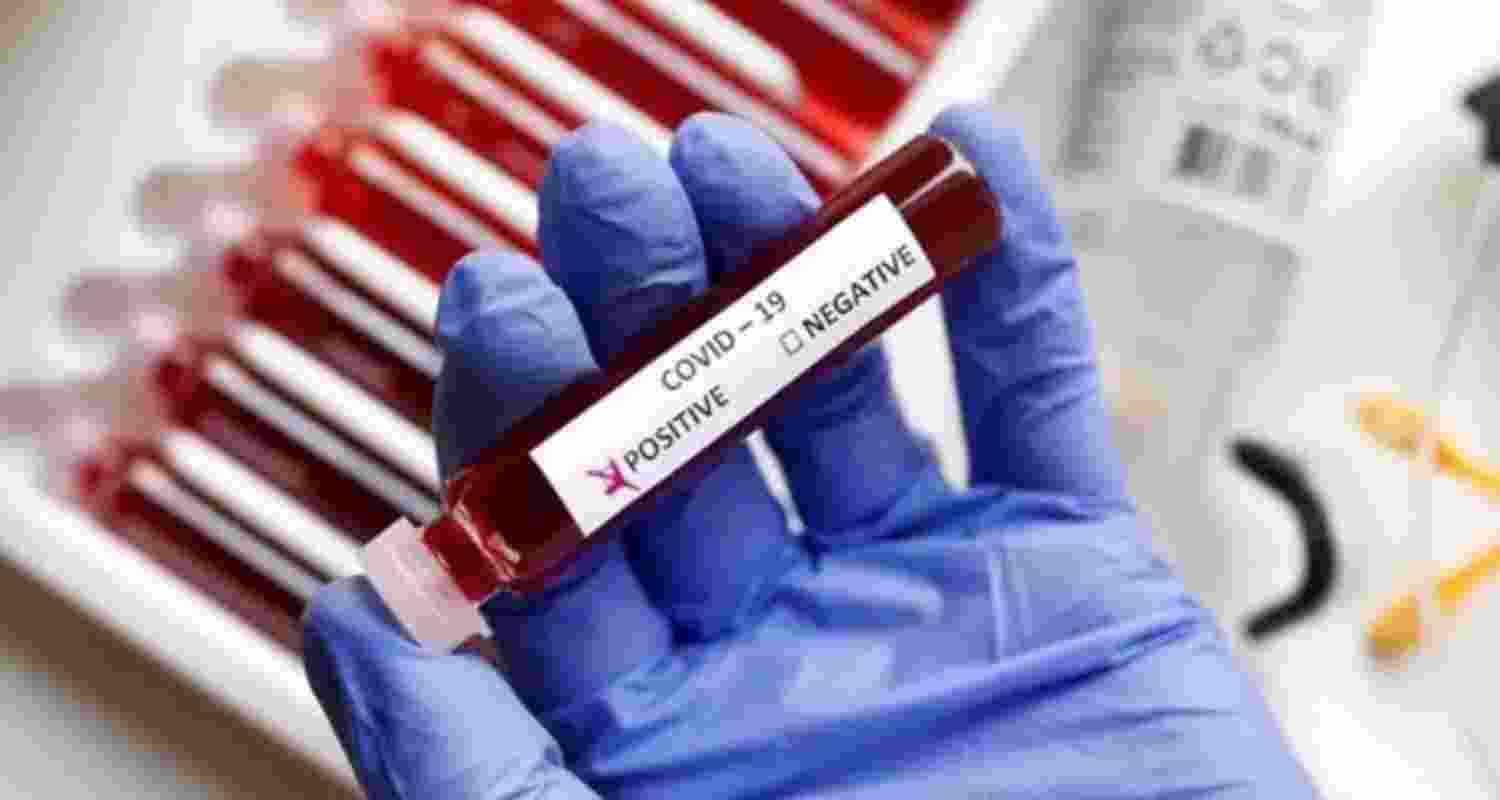 Representational Image.