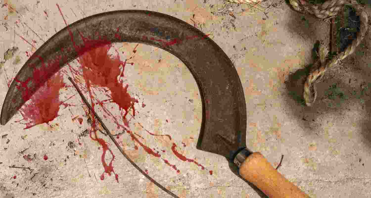 Representative Image. 